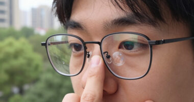 Weird Bubble In My Right Lens